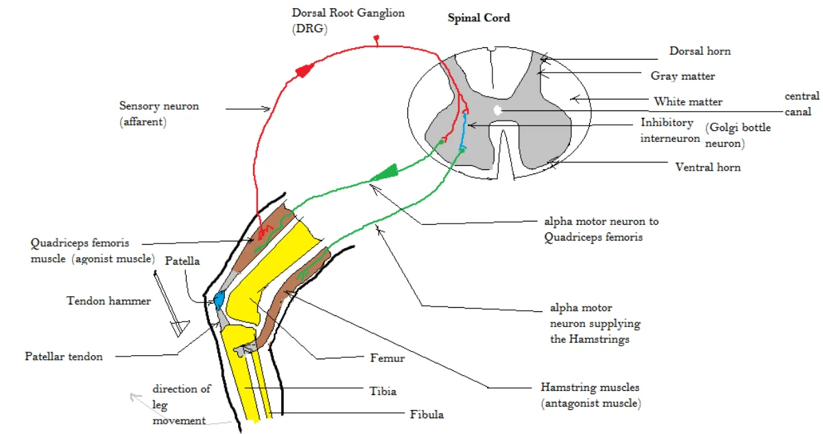 Diagram of the patellar (knee-jerk) reflex arc. A tendon hammer strikes the patellar tendon, stretching the quadriceps. A red sensory (afferent) neuron carries the signal from the muscle spindle through the dorsal root ganglion into the dorsal horn of the spinal cord, where it synapses directly on a green alpha motor neuron exiting the ventral horn back to the quadriceps. A blue inhibitory interneuron simultaneously suppresses the antagonist alpha motor neuron supplying the hamstrings