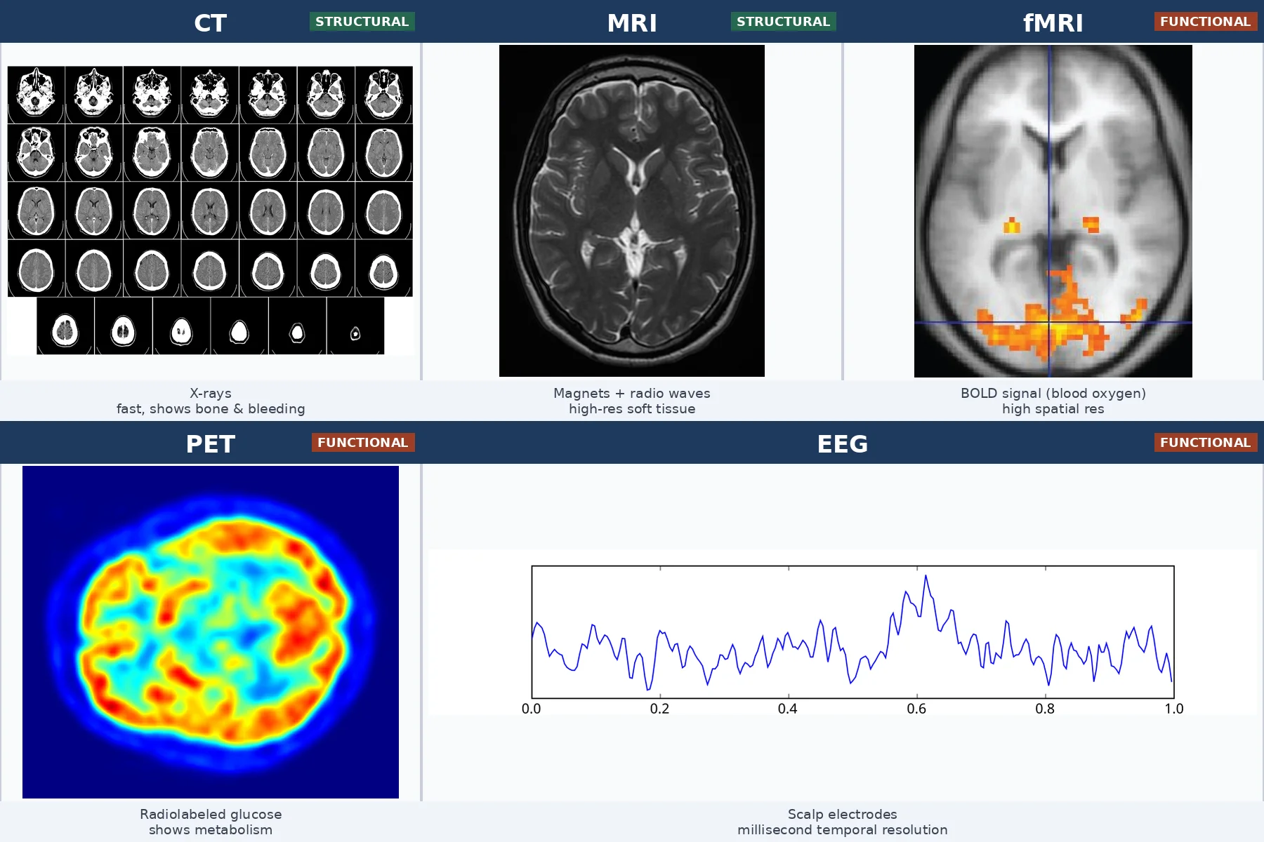 Five-panel comparison of brain imaging techniques: CT (X-ray axial slices, structural), MRI (T2-weighted axial brain, structural), fMRI (brain with yellow activation overlay, functional), PET (axial brain with red-to-blue metabolic color map, functional), and EEG (one-second raw scalp electrode waveform, functional)