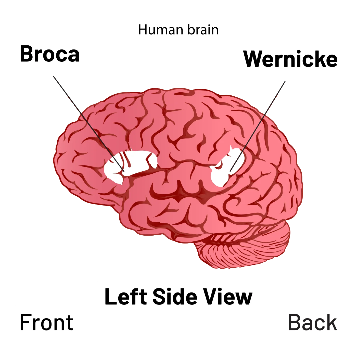 Left-side view of the human brain with Broca's area labeled in the inferior frontal gyrus (front) and Wernicke's area labeled in the posterior superior temporal gyrus (back), with anatomical orientation indicators
