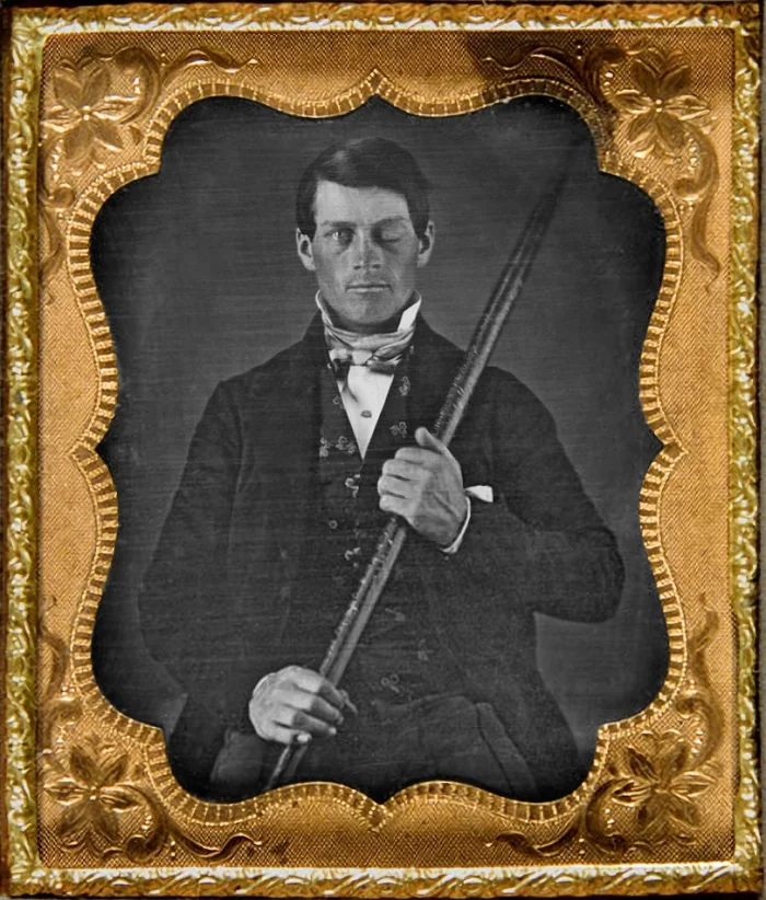 Restored daguerreotype portrait of Phineas Gage, a young man in 19th-century formal attire holding the iron tamping rod that was blown through his skull. His left eye is closed where the rod entered