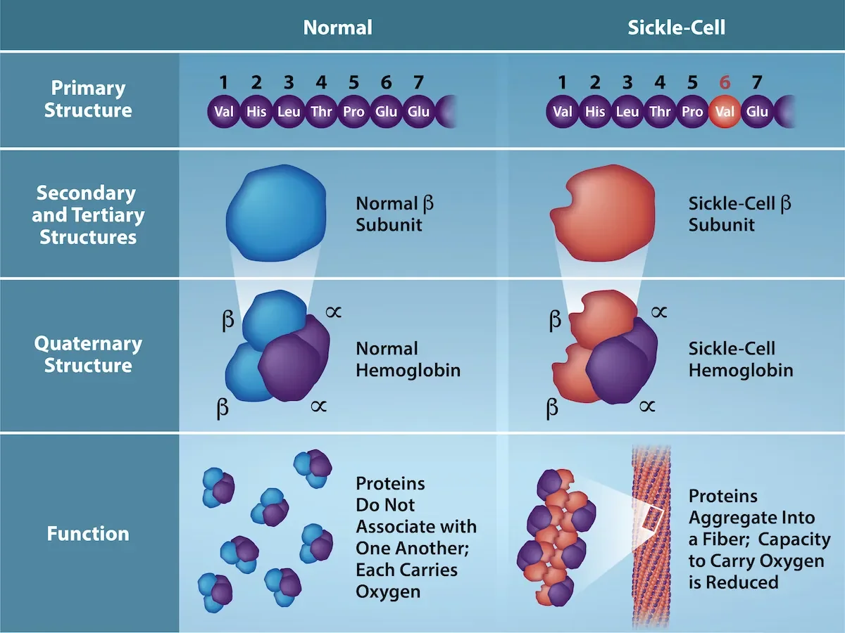 Comparison of normal hemoglobin and sickle cell hemoglobin at the primary, secondary, and tertiary structure levels. A single amino acid substitution (glutamate to valine) at position 6 of the beta chain changes the tertiary structure and the shape of red blood cells