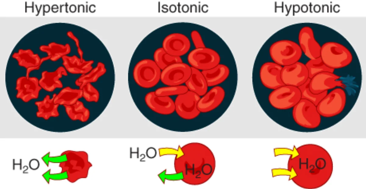 Effect of tonicity on red blood cells: hypertonic solution causes crenation (shrinking), isotonic maintains normal shape, hypotonic causes lysis (swelling and bursting)