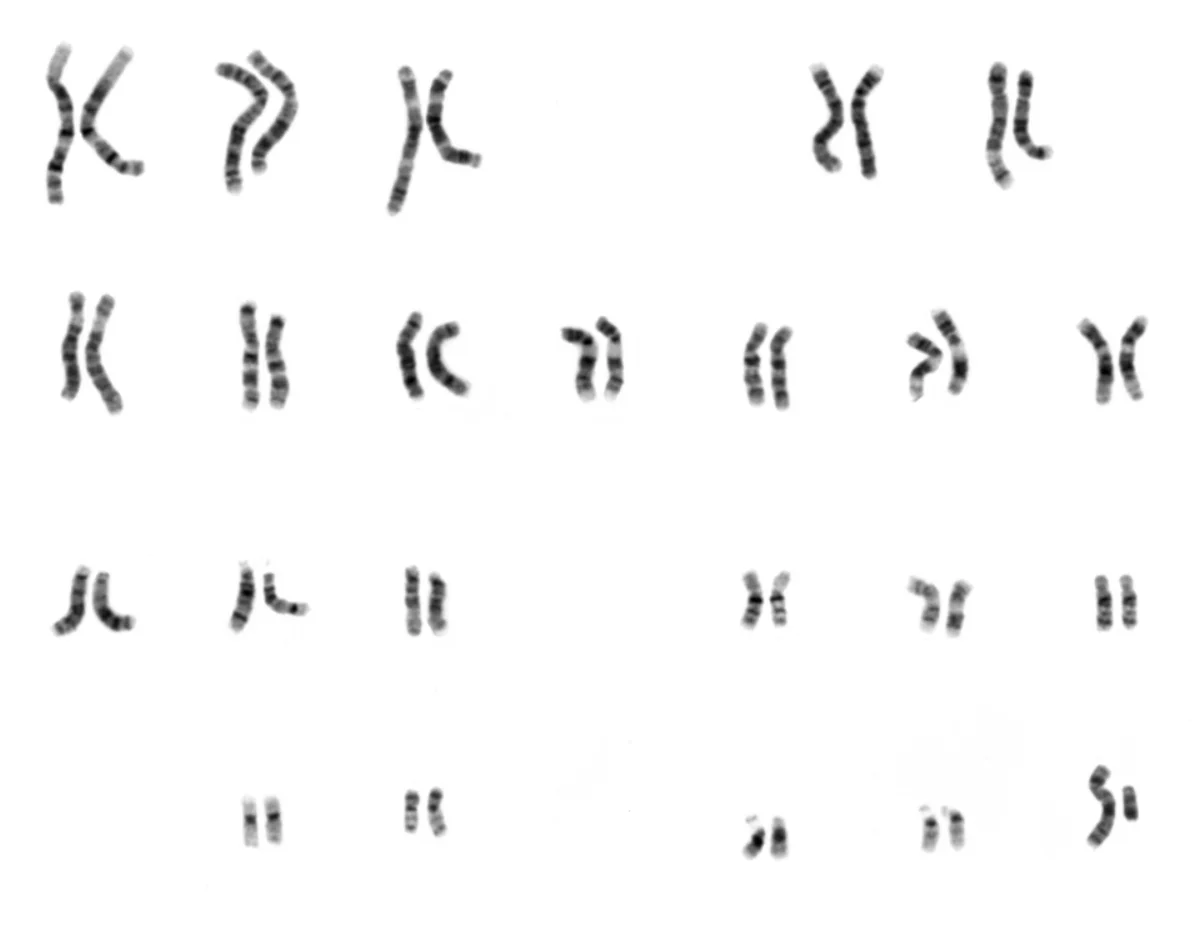 Human male karyotype showing 22 pairs of autosomes and one pair of sex chromosomes (XY), arranged by size from chromosome 1 to 22