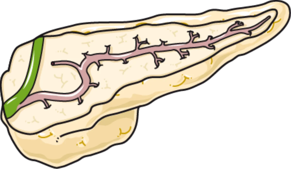 Medical illustration showing a cross-section of the pancreas with both exocrine acinar cells and endocrine islet cells visible