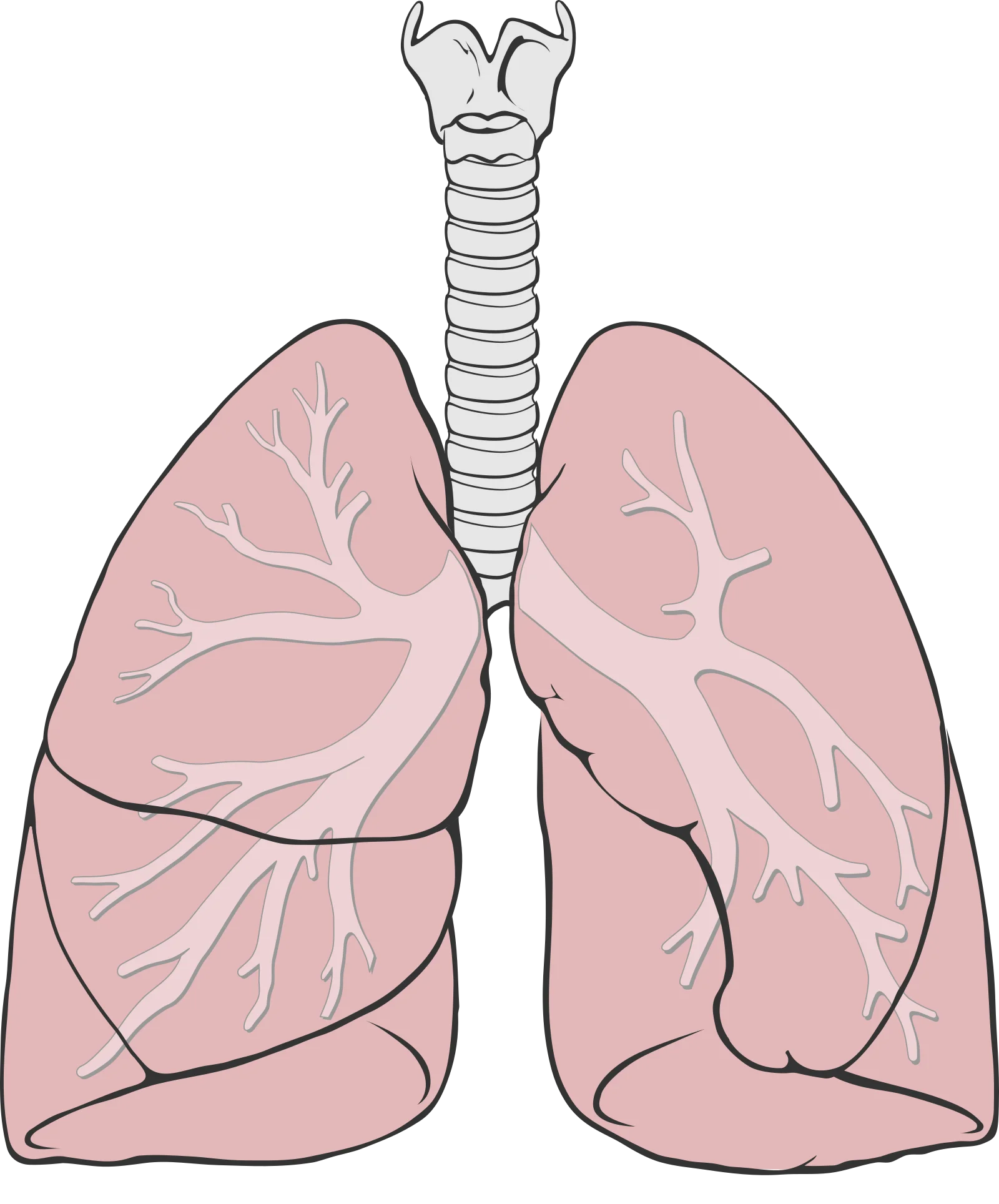 Simple labeled diagram of lung anatomy showing trachea, bronchi, bronchioles, and lung lobes