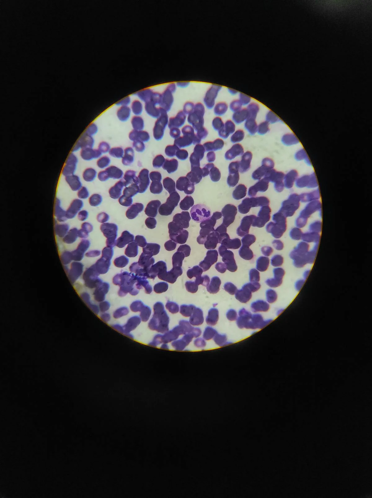 Wright-stained blood smear viewed through a microscope showing stained blood cells at high magnification