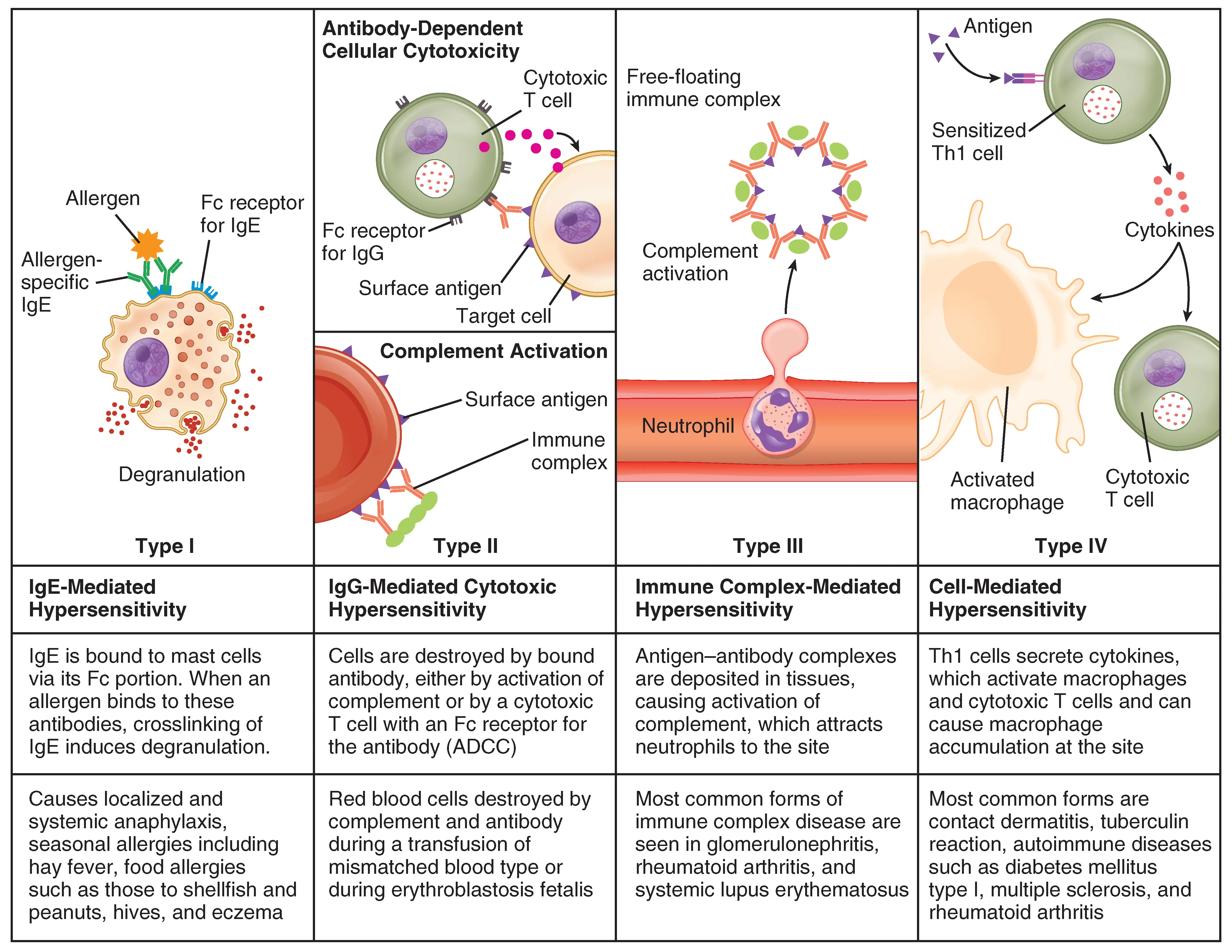 Comparison diagram of the four types of hypersensitivity reactions: Type I (IgE-mediated, mast cell degranulation), Type II (IgG/IgM cytotoxic, attacks cell surfaces), Type III (immune complex deposition), and Type IV (T cell-mediated delayed)