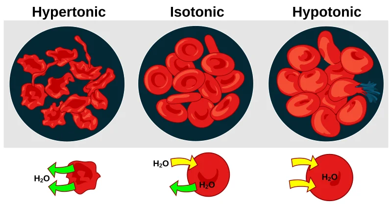 Diagram showing the effect of osmotic pressure on red blood cells in three solutions: hypertonic causing crenation and cell shrinkage, isotonic maintaining normal cell shape, and hypotonic causing cell swelling and lysis
